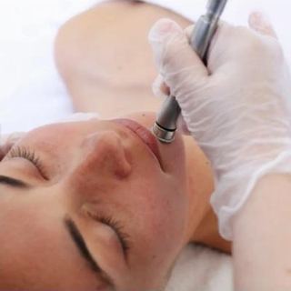 DermaSweep wand on the skin